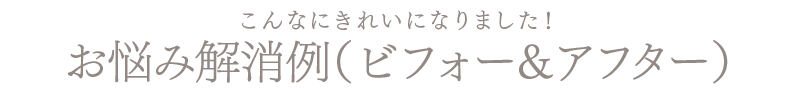 お悩み解消例（ビフォー＆アフター） 秋田 エステ サロン