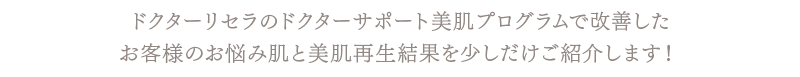 ドクターリセラのドクターサポート美肌プログラムで改善したお客様のお悩み肌と美肌再生結果を少しだけご紹介します！